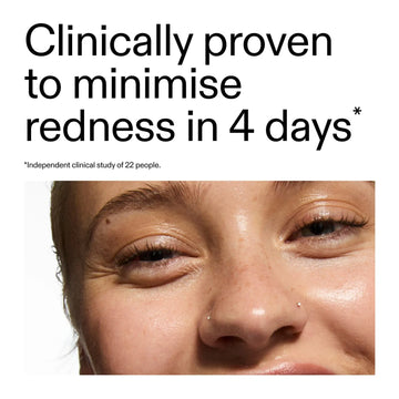 Azelaic Acid Serum